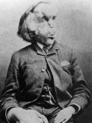 Photo of Joseph Merrick